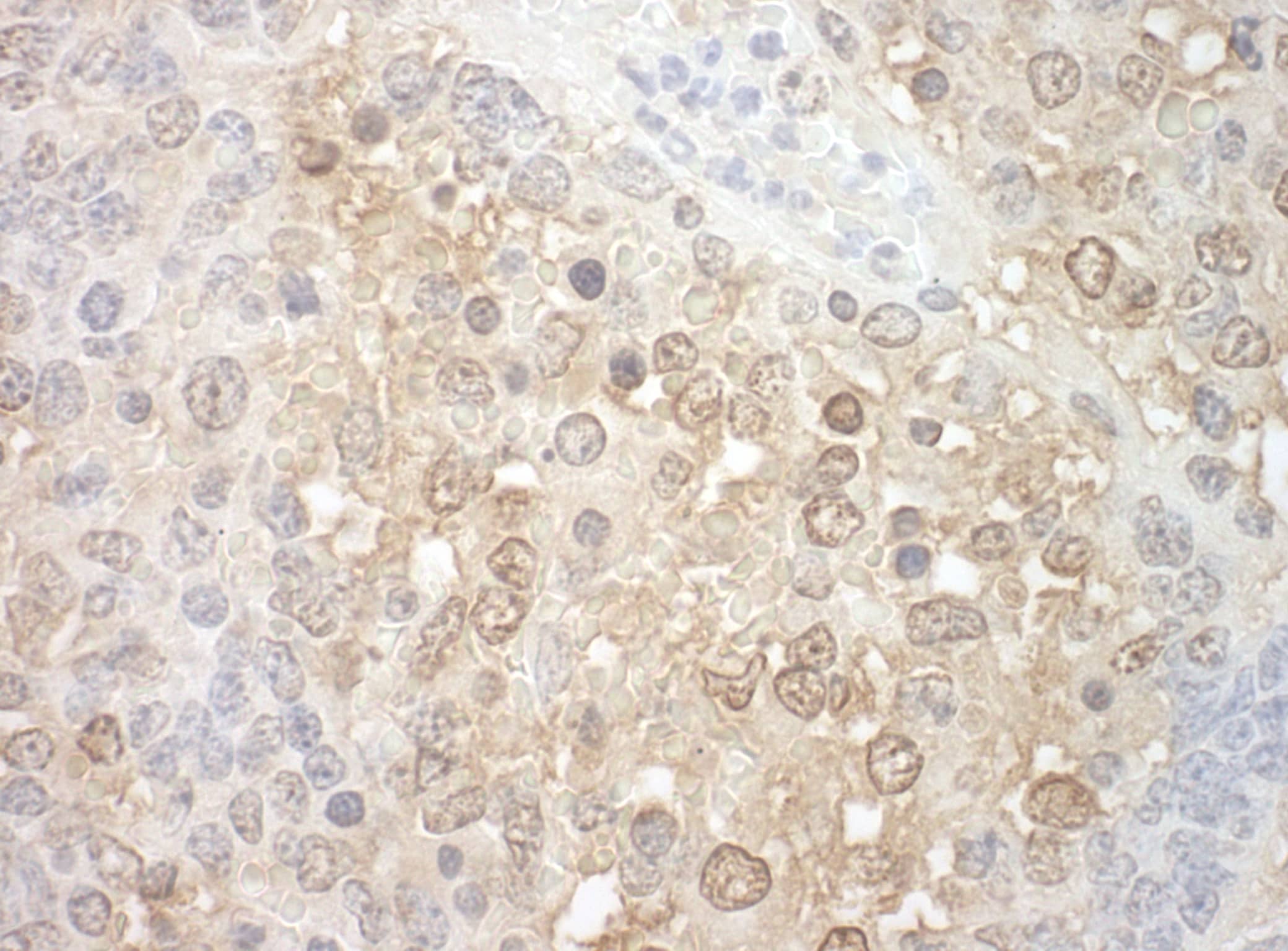 Immunohistochemistry:[NBP3-29216]-Detection of mouse TFIP11 by immunohistochemistry. Sample: FFPE section of mouse teratoma. Antibody: Affinity purified rabbit anti-TFIP11.