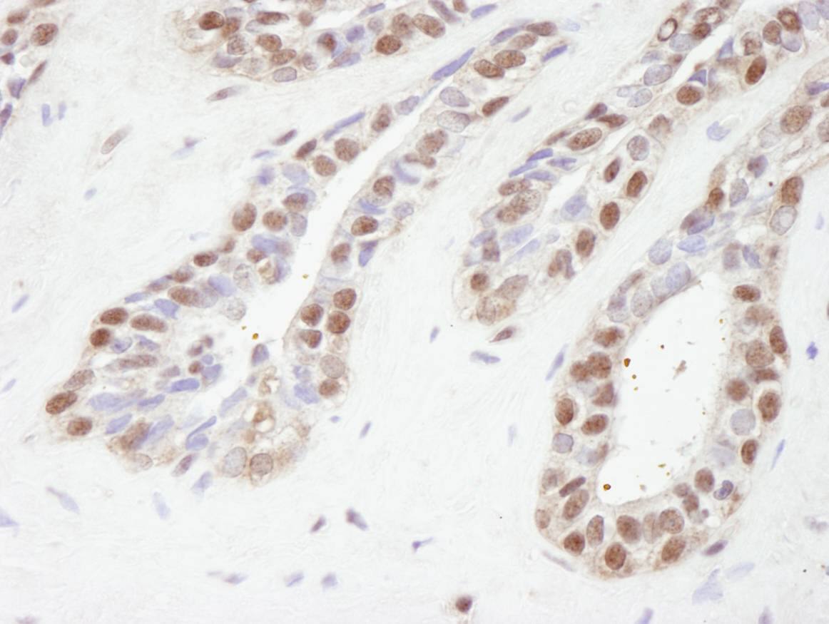 Immunohistochemistry:[NBP3-29218]-Detection of human TBLR1 by immunohistochemistry. Sample: FFPE section of human prostate. Antibody: Affinity purified rabbit anti-TBLR1.
