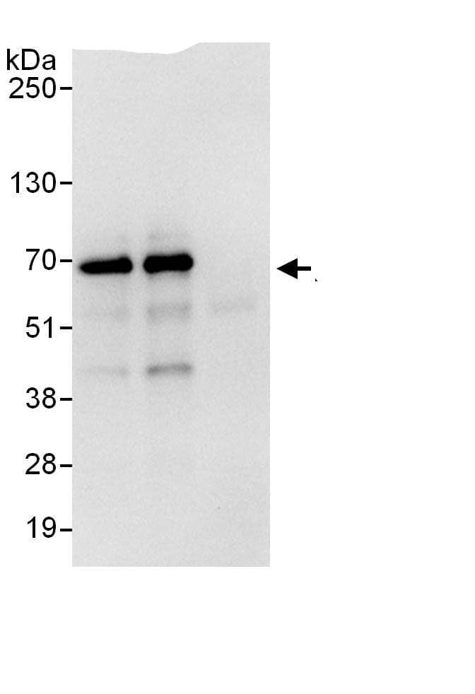 Immunoprecipitation:RGS14 AntibodyNBP3-29220] -Detection of human RGS14 by western blot of immunoprecipitates. Samples: Whole cell lysate (1 mg for IP, 20% of IP loaded) from Jurkat cells. Antibodies: Affinity purified rabbit anti-RGS14 antibody NBP3-29220 used for IP at 6 µg/mg lysate. RGS14 was also immunoprecipitated by rabbit anti-RGS14., which recognizes a downstream epitope. For blotting immunoprecipitated RGS14, A303-797 was used at 1 µg/ml. Detection: Chemiluminescence with an exposure time of 10 seconds.