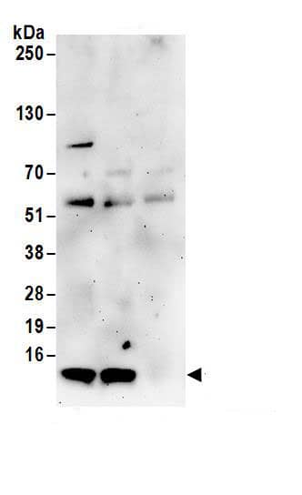 Immunoprecipitation:TIMM8A AntibodyNBP3-29221] -Detection of human TIMM8A by western blot of immunoprecipitates. Samples: Whole cell lysate (1 mg for IP; 20% of IP loaded) from HEK293T cells. Antibodies: Affinity purified rabbit anti-TIMM8A antibody NBP3-29221 (lot NBP3-29221-1) used for IP at 6 µg/mg lysate. TIMM8A was also immunoprecipitated by rabbit anti-TIMM8A antibody. For blotting immunoprecipitated TIMM8A, NBP3-29221 was used at 1 µg/ml. Detection: Chemiluminescence with an exposure time of 3 minutes.