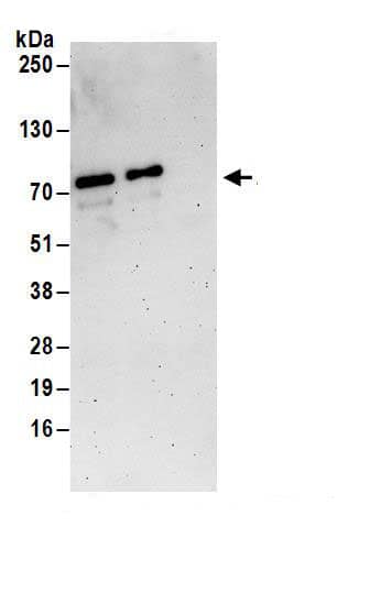 Immunoprecipitation:ZNF358 AntibodyNBP3-29222] -Detection of human ZNF358 by western blot of immunoprecipitates. Samples: Whole cell lysate (1 mg for IP; 20% of IP loaded) from 293T cells. Antibodies: Affinity purified rabbit anti-ZNF358 antibody NBP3-29222 (lot NBP3-29222-1) used for IP at 6 µg/mg lysate. ZNF358 was also immunoprecipitated by rabbit anti-ZNF358.. For blotting immunoprecipitated ZNF358, NBP3-29222 was used at 1 µg/ml. Detection: Chemiluminescence with an exposure time of 3 minutes.