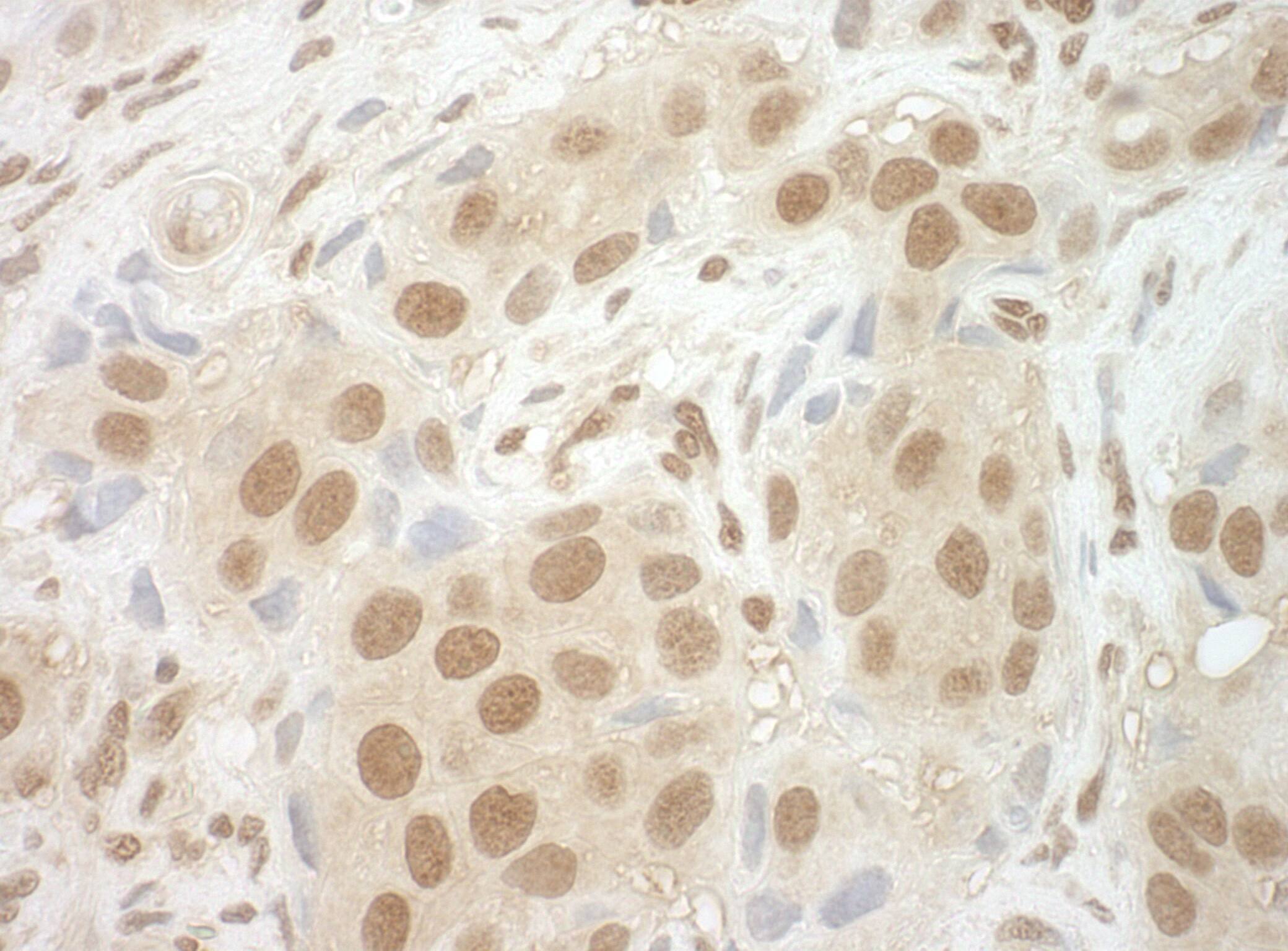 Immunohistochemistry CBP20 Antibody