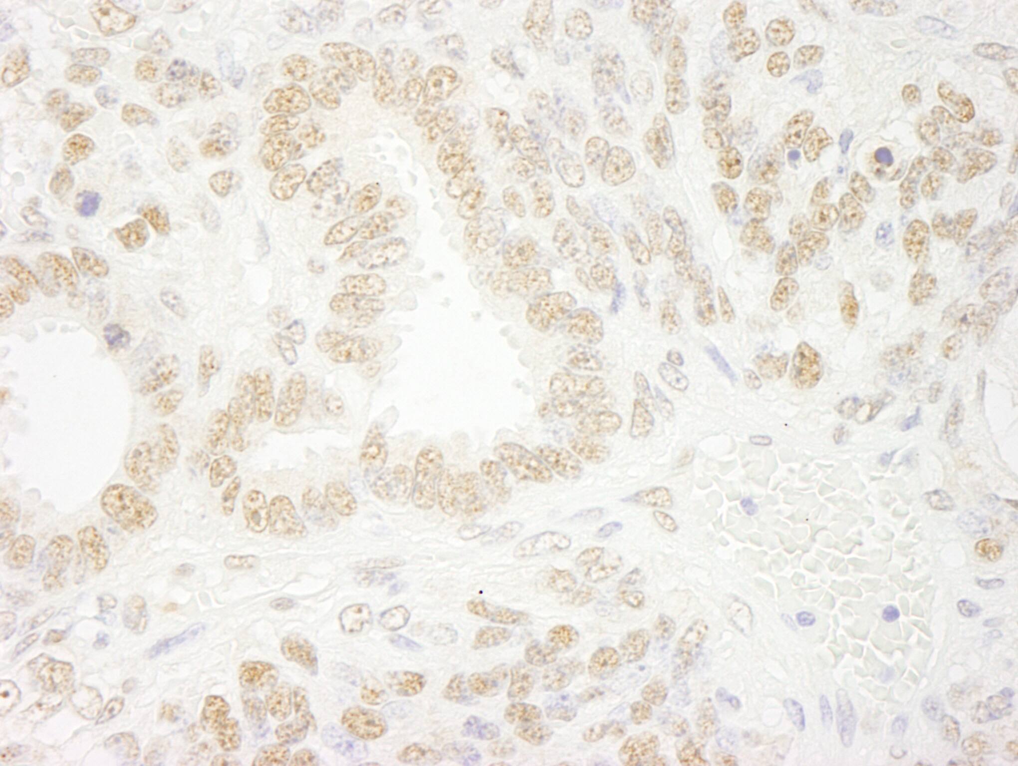 Immunohistochemistry ZNF198 Antibody