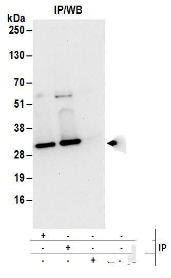 Immunoprecipitation:[NBP3-29230]-Detection of human E2-EPF by western blot of immunoprecipitates. Samples: Whole cell lysate from 293T cells. Antibodies: Affinity purified rabbit anti-E2-EPF antibody used for IP at 6 µg/mg lysate. E2-EPF was also immunoprecipitated by rabbit anti-E2-EPF antibody. For blotting immunoprecipitated E2-EPF, was used at 1 µg/ml. Detection: Chemiluminescence with an exposure time of 10 seconds.