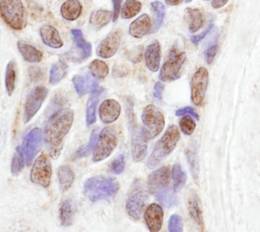 Immunohistochemistry:[NBP3-29234]-Detection of human CoAA by immunohistochemistry. Sample: FFPE section of human prostate. Antibody: Affinity purified rabbit.