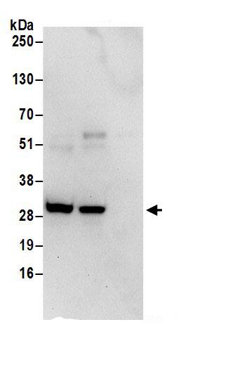 Immunoprecipitation:CHMP2B AntibodyNBP3-29240] -Detection of human CHMP2B by western blot of immunoprecipitates. Samples: Whole cell lysate (0.5 or 1.0 mg per IP reaction; 20% of IP loaded) from 293T cells prepared using NETN lysis buffer. Antibodies: Affinity purified rabbit anti-CHMP2B antibody NBP3-29240 (lot NBP3-29240-1) used for IP at 6 µg per reaction. CHMP2B was also immunoprecipitated by rabbit anti-CHMP2B antibody BL17027. For blotting immunoprecipitated CHMP2B, A304-501A was used at 1 µg/ml. Detection: Chemiluminescence with an exposure time of 30 seconds.