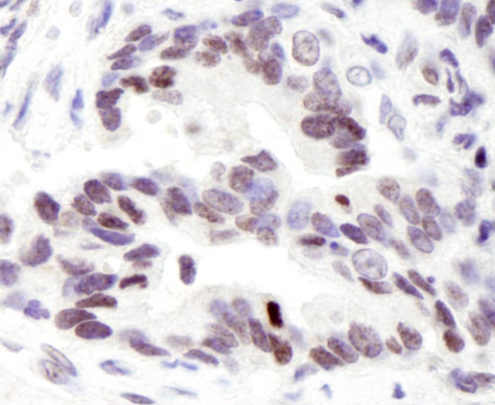 Immunohistochemistry:[NBP3-29243]-Detection of human ASC2 by immunohistochemistry. Sample: FFPE section of human stomach. Antibody: Affinity purified rabbit anti-ASC2.