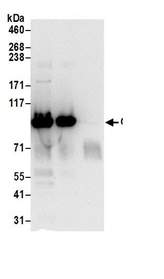Immunoprecipitation:OSBP1 AntibodyNBP3-29244] -Detection of human OSBP by western blot of immunoprecipitates. Samples: Whole cell lysate (0.5 or 1.0 mg per IP reaction; 20% of IP loaded) from 293T cells prepared using NETN lysis buffer. Antibodies: Affinity purified rabbit anti-OSBP antibody NBP3-29244 (lot NBP3-29244-1) used for IP at 6 µg per reaction. OSBP was also immunoprecipitated by rabbit anti-OSBP antibody for blotting immunoprecipitated OSBP, NBP3-29244 was used at 1 µg/ml. Detection: Chemiluminescence with an exposure time of 30 seconds.
