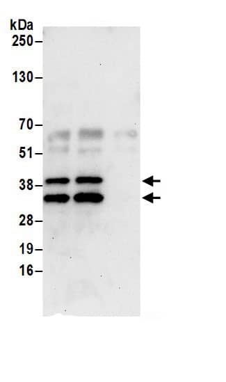 Immunoprecipitation:CDV3 AntibodyNBP3-29246] -Detection of human CDV3 by western blot of immunoprecipitates. Samples: Whole cell lysate (0.5 or 1.0 mg per IP reaction; 10% of IP loaded) from 293T cells prepared using NETN lysis buffer. Antibodies: Affinity purified rabbit anti-CDV3 antibody NBP3-29246 (lot NBP3-29246-1) used for IP at 6 µg per reaction. CDV3 was also immunoprecipitated by rabbit anti-CDV3 antibody. For blotting immunoprecipitated CDV3, NBP3-29246 was used at 1 µg/ml. Detection: Chemiluminescence with an exposure time of 30 seconds.