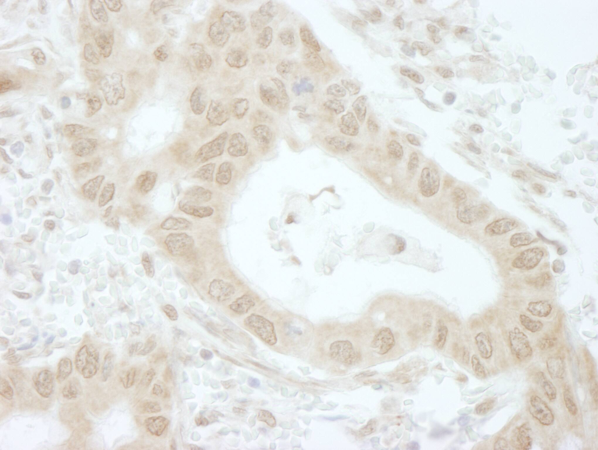 Immunohistochemistry:[NBP3-29247]-Detection of human Tip41 by immunohistochemistry. Sample: FFPE section of human lung. Antibody: Affinity purified rabbit anti-Tip41.