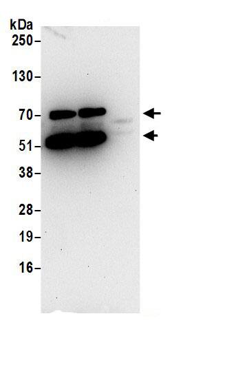 Immunoprecipitation:ARL6IP4 AntibodyNBP3-29251] -Detection of human ARL6IP4 by western blot of immunoprecipitates. Samples: Whole cell lysate (0.5 or 1.0 mg per IP reaction; 20% of IP loaded) from 293T cells prepared using NETN lysis buffer. Antibodies: Affinity purified rabbit anti-ARL6IP4 antibody NBP3-29251 (lot NBP3-29251-1) used for IP at 6 µg per reaction. ARL6IP4 was also immunoprecipitated by rabbit anti-ARL6IP4.. For blotting immunoprecipitated ARL6IP4, NBP3-29251 was used at 0.4 µg/ml. Detection: Chemiluminescence with an exposure time of 30 seconds.