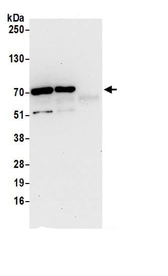 Immunoprecipitation:CCDC9 AntibodyNBP3-29253] -Detection of human CCDC9 by western blot of immunoprecipitates. Samples: Whole cell lysate (0.5 or 1.0 mg per IP reaction; 20% of IP loaded) from 293T cells prepared using NETN lysis buffer. Antibody: Affinity purified rabbit anti-CCDC9 antibody NBP3-29253 (lot NBP3-29253-1) used for IP at 6 µg per reaction. CCDC9 was also immunoprecipitated by rabbit anti-CCDC9 antibody. For blotting immunoprecipitated CCDC9, NBP3-29253 was used at 0.4 µg/ml. Detection: Chemiluminescence with an exposure time of 30 seconds.