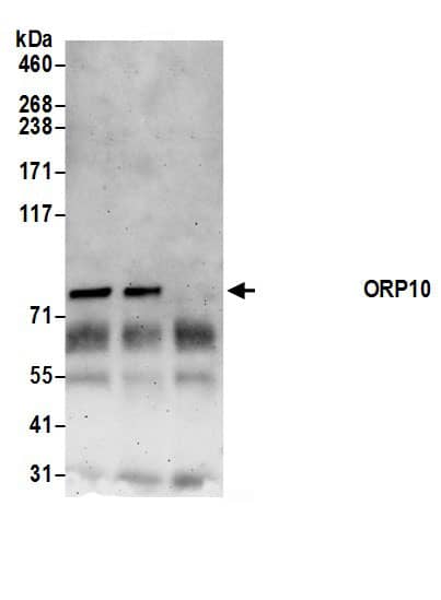 Immunoprecipitation:OSBPL10 AntibodyNBP3-29262] -Detection of human OSBPL10/ORP10 by western blot of immunoprecipitates. Samples: Whole cell lysate (0.5 or 1.0 mg per IP reaction; 20% of IP loaded) from HeLa cells prepared using NETN lysis buffer. Antibodies: Affinity purified rabbit anti-OSBPL10/ORP10 antibody NBP3-29262 (lot NBP3-29262-1) used for IP at 6 µg per reaction. OSBPL10/ORP10 was also immunoprecipitated by rabbit anti-OSBPL10/ORP10 antibody BL19171. For blotting immunoprecipitated OSBPL10/ORP10, NBP3-29262 was used at 1 µg/ml. Detection: Chemiluminescence with an exposure time of 3 minutes.