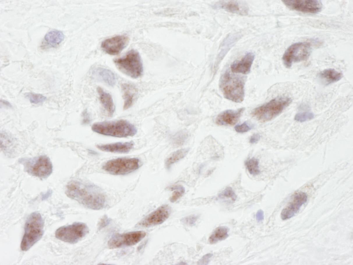 Immunohistochemistry:[NBP3-29266]-Detection of human PNUTS by immunohistochemistry. Sample: FFPE section of human breast. Antibody: Affinity purified rabbit anti-PNUTS.