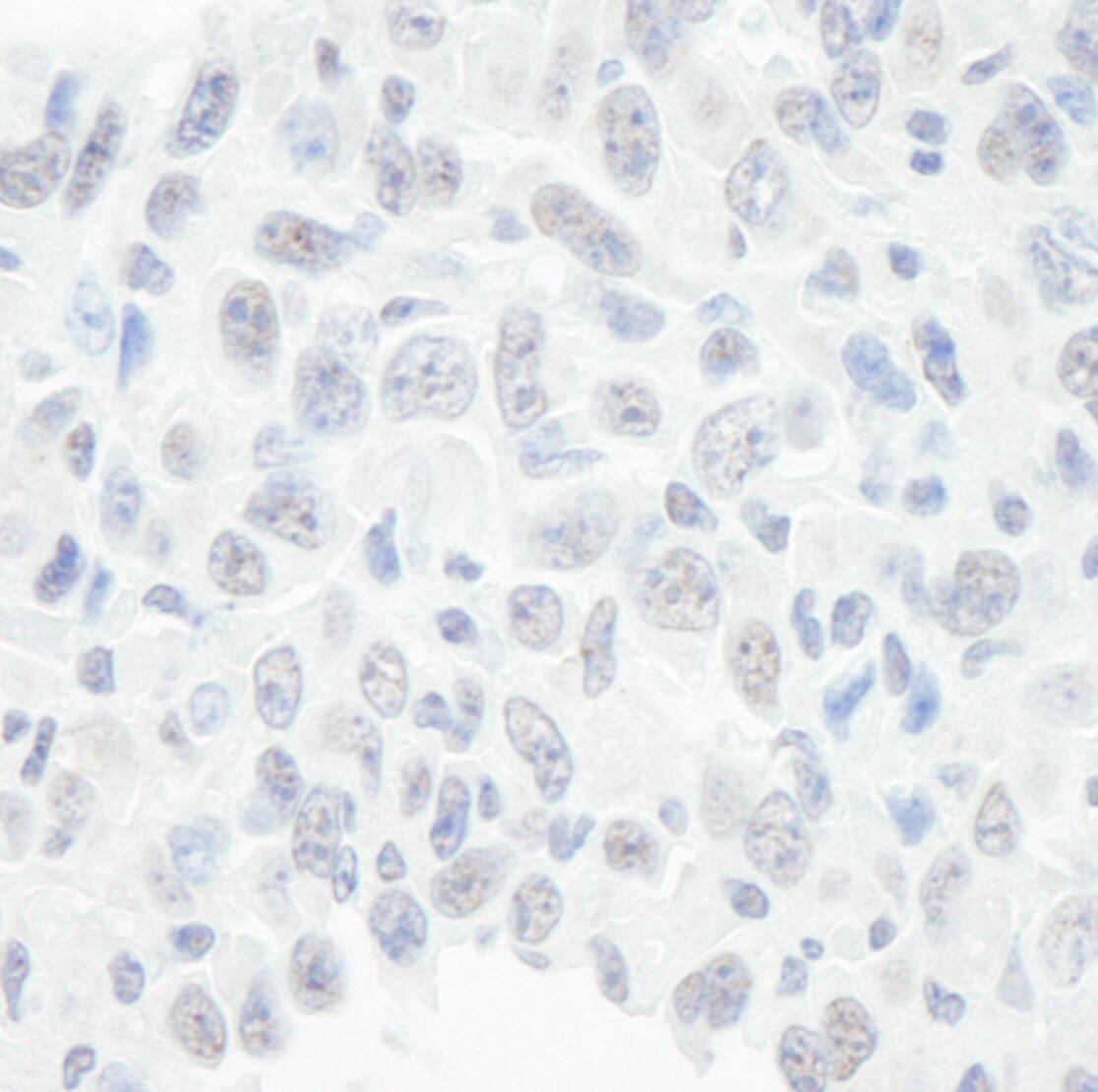 Immunohistochemistry:[NBP3-29267]-Detection of mouse BAF57/SMARCE1 by immunohistochemistry. Sample: FFPE section of mouse squamous cell carcinoma. Antibody: Affinity purified rabbit anti-BAF57/SMARCE1.