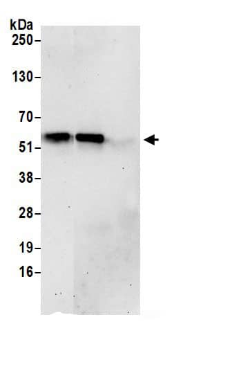 Immunoprecipitation:PUS3 AntibodyNBP3-29270] -Detection of human PUS3 by western blot of immunoprecipitates. Samples: Whole cell lysate (0.5 or 1.0 mg per IP reaction; 20% of IP loaded) from 293T cells prepared using NETN lysis buffer. Antibodies: Affinity purified rabbit anti-PUS3 antibody NBP3-29270 (lot NBP3-29270-1) used for IP at 6 µg per reaction. PUS3 was also immunoprecipitated by rabbit anti-PUS3 antibody NBP3-29270. For blotting immunoprecipitated PUS3,  was used at 1 µg/ml. Detection: Chemiluminescence with an exposure time of 30 seconds.