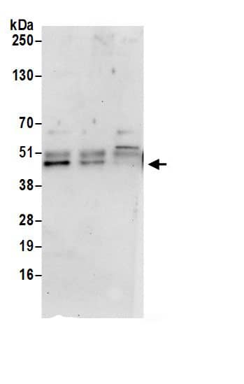 Immunoprecipitation:VPS37A AntibodyNBP3-29271] -Detection of human VPS37A by western blot of immunoprecipitates. Samples: Whole cell lysate (0.5 or 1.0 mg per IP reaction; 20% of IP loaded) from 293T cells prepared using NETN lysis buffer. Antibodies: Affinity purified rabbit anti-VPS37A antibody NBP3-29271 (lot NBP3-29271-1) used for IP at 6 µg per reaction. VPS37A was also immunoprecipitated by rabbit anti-VPS37A.. For blotting immunoprecipitated VPS37A, A304-963A was used at 0.4 µg/ml. Detection: Chemiluminescence with an exposure time of 30 seconds.