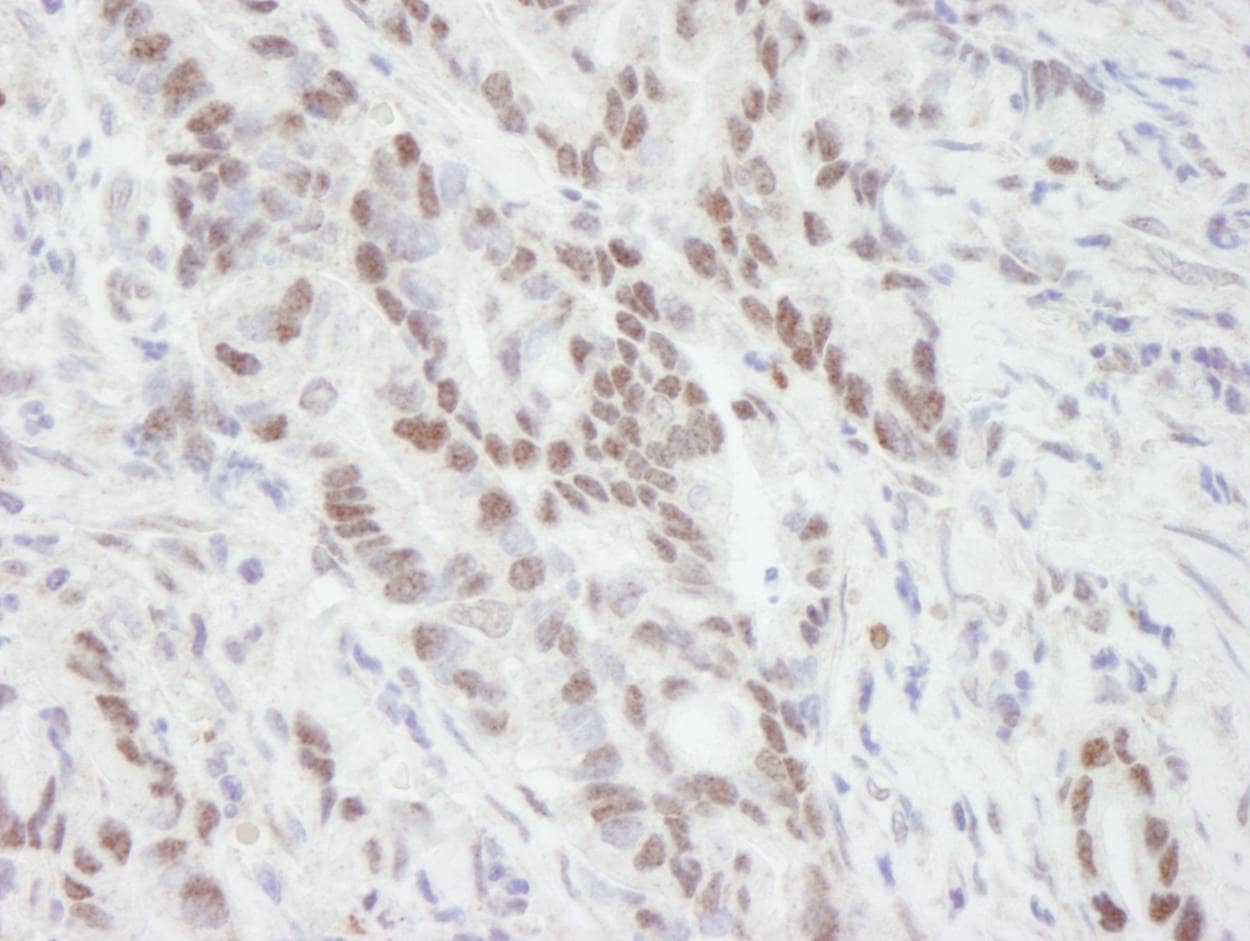 Immunohistochemistry:[NBP3-29272]-Detection of human MTA1 by immunohistochemistry. Sample: FFPE section of human stomach. Antibody: Affinity purified rabbit anti-MTA1.