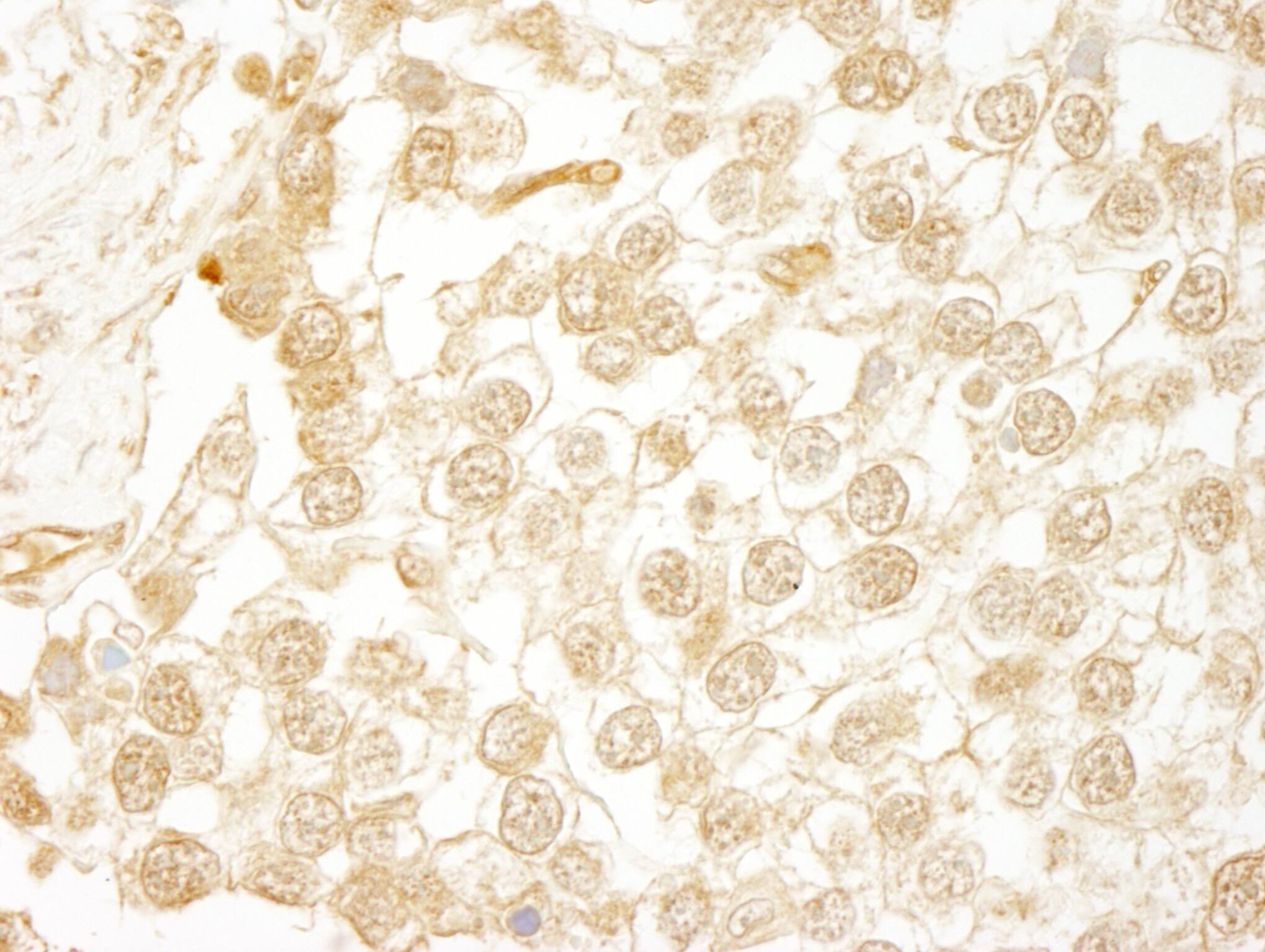 Immunohistochemistry WDR20 Antibody