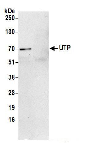 Immunoprecipitation:UTP15 AntibodyNBP3-29279] -Detection of human UTP15 by western blot of immunoprecipitates. Samples: Whole cell lysate (0.5 or 1.0 mg per IP reaction; 20% of IP loaded) from 293T cells prepared using NETN lysis buffer. Antibodies: Affinity purified rabbit anti-UTP15 antibody NBP3-29279 (lot NBP3-29279-1) used for IP at 6 µg per reaction. For blotting immunoprecipitated UTP15, NBP3-29279 was used at 1 µg/ml. Detection: Chemiluminescence with an exposure time of 30 seconds.