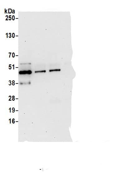 Immunoprecipitation:Alpha-parvin/Actopaxin AntibodyNBP3-29281] -Detection of human PARVA by western blot of immunoprecipitates. Samples: Whole cell lysate (0.5 or 1.0 mg per IP reaction; 20% of IP loaded) from 293T cells prepared using NETN lysis buffer. Antibodies: Affinity purified rabbit anti-PARVA antibody NBP3-29281 (lot NBP3-29281-1) used for IP at 6 µg per reaction. PARVA was also immunoprecipitated rabbit anti-PARVA antibodies BL20805 and BL20806. For blotting immunoprecipitated PARVA, NBP3-29281 was used at 1 µg/ml. Detection: Chemiluminescence with an exposure time of 30 seconds.