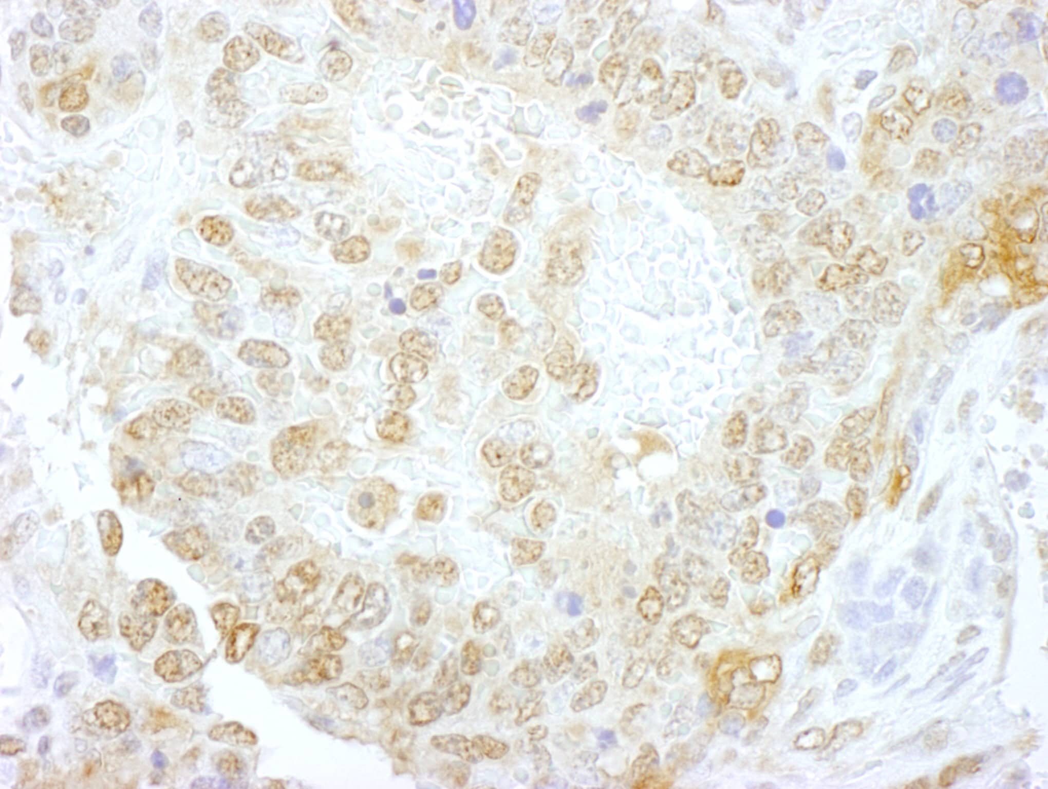 Immunohistochemistry:[NBP3-29284]-Detection of mouse NCBP1/CBP80 by immunohistochemistry. Sample: FFPE section of mouse teratoma. Antibody: Affinity purified rabbit anti-NCBP1/CBP80.