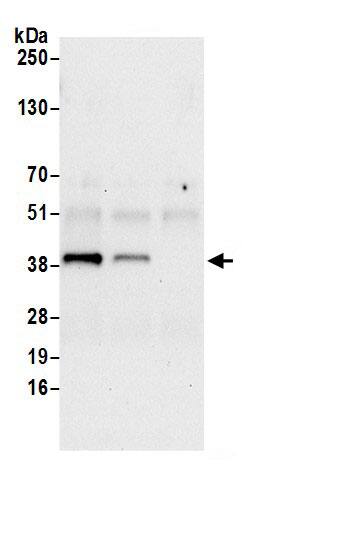 Immunoprecipitation:DHCR7 AntibodyNBP3-29288] -Detection of human DHCR7 by western blot of immunoprecipitates. Samples: Whole cell lysate (0.5 or 1.0 mg per IP reaction; 20% of IP loaded) from 293T cells prepared using NETN lysis buffer. Antibodies: Affinity purified rabbit anti-DHCR7 antibody NBP3-29288 (lot NBP3-29288-1) used for IP at 6 µg per reaction. DHCR7 was also immunoprecipitated by rabbit anti-DHCR7 antibody BL21078. For blotting immunoprecipitated DHCR7, NBP3-29288 was used at 1 µg/ml. Detection: Chemiluminescence with an exposure time of 30 seconds.