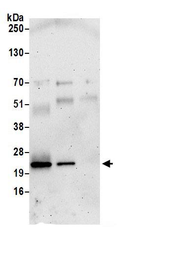 Immunoprecipitation:Rab1A AntibodyNBP3-29295] -Detection of human RAB1A by western blot of immunoprecipitates. Samples: Whole cell lysate (0.5 or 1.0 mg per IP reaction; 20% of IP loaded) from 293T cells prepared using NETN lysis buffer. Antibodies: Affinity purified rabbit anti-RAB1A antibody NBP3-29295 (lot NBP3-29295-1) used for IP at 6 µg per reaction. RAB1A was also immunoprecipitated by rabbit anti-RAB1A.. For blotting immunoprecipitated RAB1A, NBP3-29295 was used at 1 µg/ml. Detection: Chemiluminescence with an exposure time of 3 minutes.