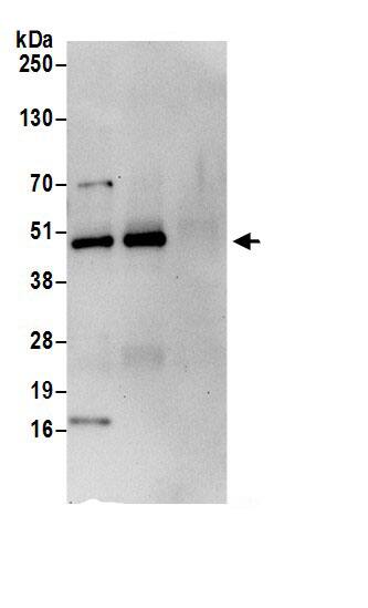 Immunoprecipitation:Calumenin AntibodyNBP3-29296] -Detection of human CALU by western blot of immunoprecipitates. Samples: Whole cell lysate (0.5 or 1.0 mg per IP reaction; 20% of IP loaded) from 293T cells prepared using NETN lysis buffer. Antibodies: Affinity purified rabbit anti-CALU antibody NBP3-29296 (lot NBP3-29296-1) used for IP at 6 µg per reaction. CALU was also immunoprecipitated by rabbit anti-CALU.. For blotting immunoprecipitated CALU, NBP3-29296 was used at 1 µg/ml. Detection: Chemiluminescence with an exposure time of 30 seconds.