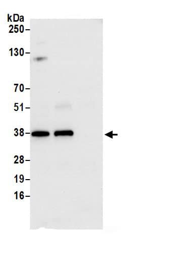 Immunoprecipitation:HO-2/HMOX2 AntibodyNBP3-29297] -Detection of human HMOX2 by western blot of immunoprecipitates. Samples: Whole cell lysate (0.5 or 1.0 mg per IP reaction; 20% of IP loaded) from 293T cells prepared using NETN lysis buffer. Antibodies: Affinity purified rabbit anti-HMOX2 antibody NBP3-29297 (lot NBP3-29297-1) used for IP at 6 µg per reaction. HMOX2 was also immunoprecipitated by rabbit anti-HMOX2.. For blotting immunoprecipitated HMOX2, NBP3-29297 was used at 1 µg/ml. Detection: Chemiluminescence with an exposure time of 10 seconds.