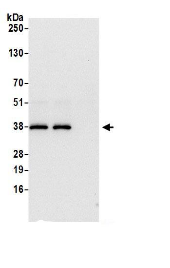 Immunoprecipitation:DCPS AntibodyNBP3-29312] -Detection of human DCPS by western blot of immunoprecipitates. Samples: Whole cell lysate (0.5 or 1.0 mg per IP reaction; 20% of IP loaded) from 293T cells prepared using NETN lysis buffer. Antibodies: Affinity purified rabbit anti-DCPS antibody NBP3-29312 (lot NBP3-29312-1) used for IP at 6 µg per reaction. DCPS was also immunoprecipitated by rabbit anti-DCPS.. For blotting immunoprecipitated DCPS, NBP3-29312 was used at 1 µg/ml. Detection: Chemiluminescence with an exposure time of 10 seconds.