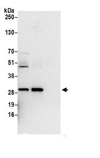 Immunoprecipitation:UCK2 AntibodyNBP3-29313] -Detection of human UCK2 by western blot of immunoprecipitates. Samples: Whole cell lysate (0.5 or 1.0 mg per IP reaction; 20% of IP loaded) from HeLa cells prepared using NETN lysis buffer. Antibodies: Affinity purified rabbit anti-UCK2 antibody NBP3-29313 (lot NBP3-29313-1) used for IP at 6 µg per reaction. UCK2 was also immunoprecipitated by rabbit anti-UCK2 antibody BL21575. For blotting immunoprecipitated UCK2, NBP3-29313 was used at 1 µg/ml. Detection: Chemiluminescence with an exposure time of 30 seconds.