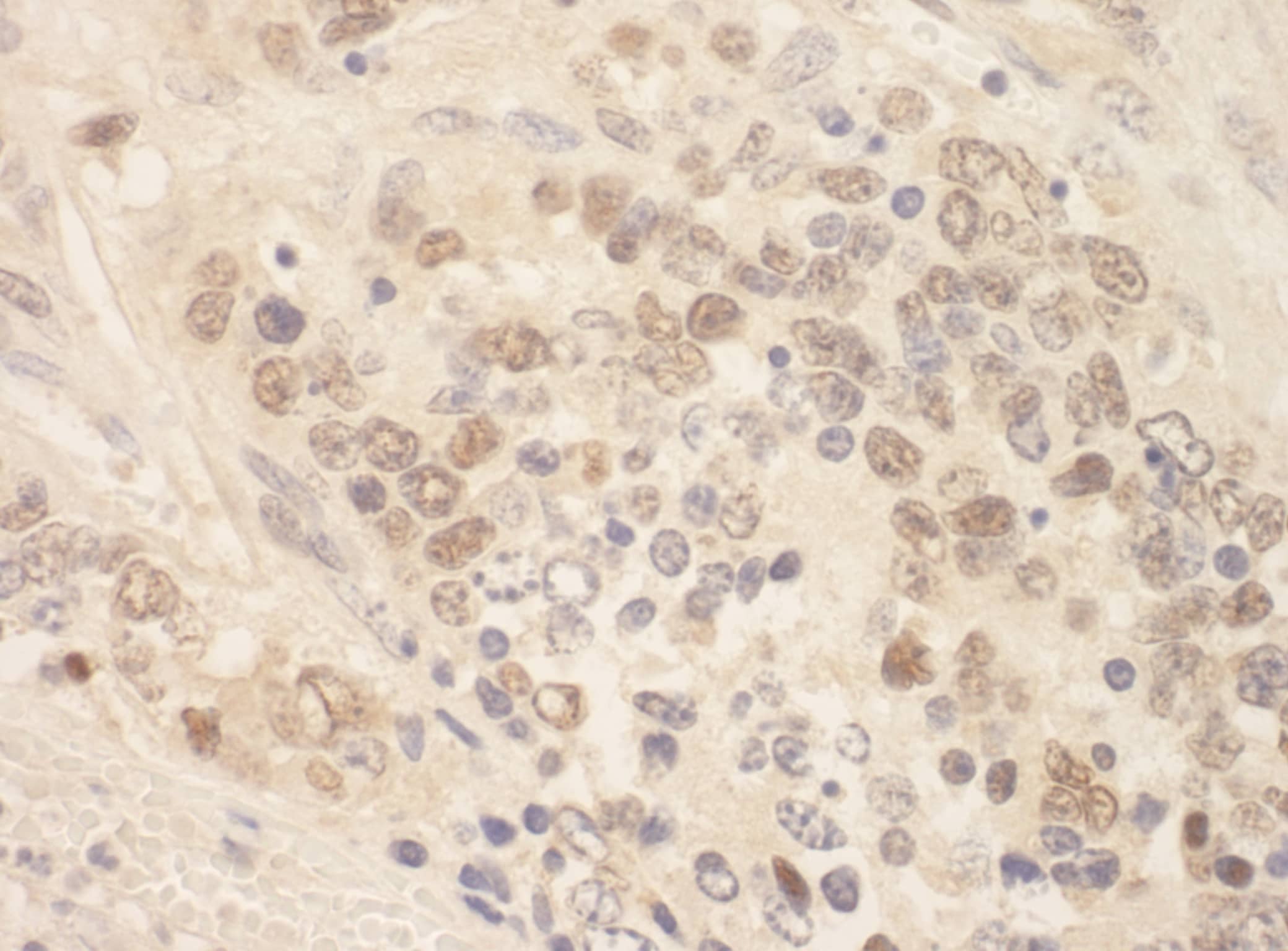 Immunohistochemistry:[NBP3-29316]-Detection of mouse SIP1 by immunohistochemistry. Sample: FFPE section of mouse teratoma. Antibody: Affinity purified rabbit anti-ZEB2/SIP.