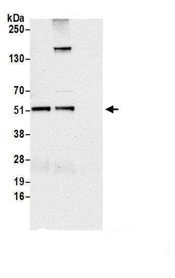 Immunoprecipitation:NARFL AntibodyNBP3-29318] -Detection of human NARFL by western blot of immunoprecipitates. Samples: Whole cell lysate (1.0 mg per IP reaction; 20% of IP loaded) from HeLa cells prepared using NETN lysis buffer. Antibodies: Affinity purified rabbit anti-NARFL antibody (NBP3-29318 lot 1) used for IP at 6 µg per reaction. NARFL was also immunoprecipitated by rabbit anti-NARFL.. For blotting immunoprecipitated NARFL, NBP3-29318 was used at 0.4 mg/ml. Detection: Chemiluminescence with an exposure time of 30 seconds.