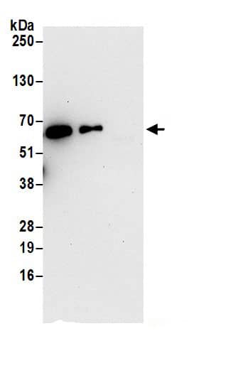 Immunoprecipitation:WDR1 AntibodyNBP3-29322] -Detection of human WDR1 by western blot of immunoprecipitates. Samples: Whole cell lysate (0.5 or 1.0 mg per IP reaction; 20% of IP loaded) from Jurkat cells prepared using NETN lysis buffer. Antibodies: Affinity purified rabbit anti-WDR1 antibody NBP3-29322 (lot NBP3-29322-1) used for IP at 6 µg per reaction. WDR1 was also immunoprecipitated by rabbit anti-WDR1.. For blotting immunoprecipitated WDR1, NBP3-29322 was used at 0.4 µg/ml. Detection: Chemiluminescence with an exposure time of 30 seconds.