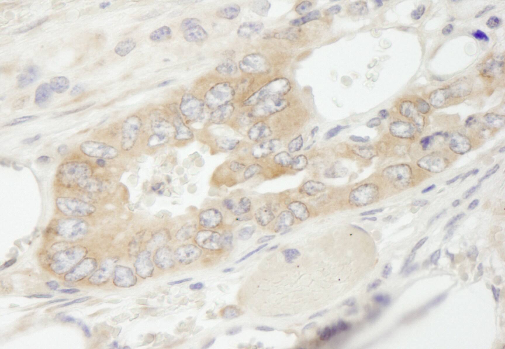 Immunohistochemistry:[NBP3-29331]-Detection of mouse eEF1G by immunohistochemistry. Sample: FFPE section of mouse teratoma. Antibody: Affinity purified rabbit anti-eEF1G.