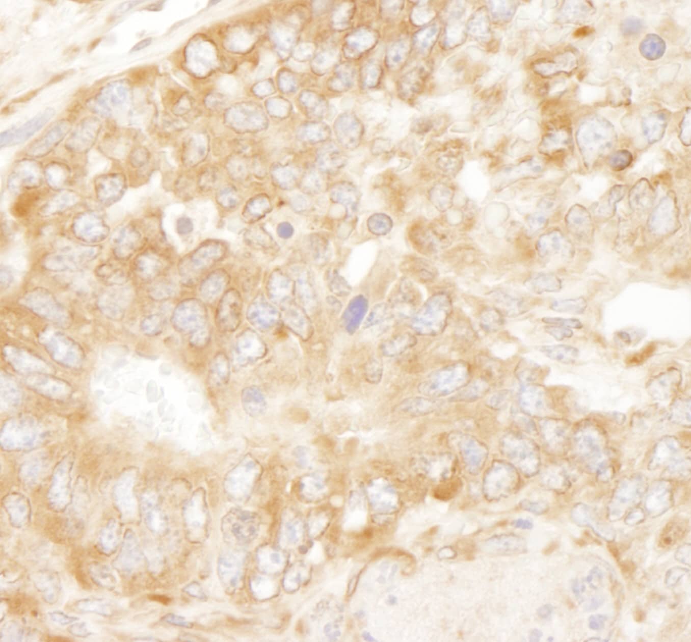 Immunohistochemistry:[NBP3-29332]-Detection of mouse RPL7 by immunohistochemistry. Sample: FFPE section of mouse teratoma. Antibody: Affinity purified rabbit anti-RPL7.