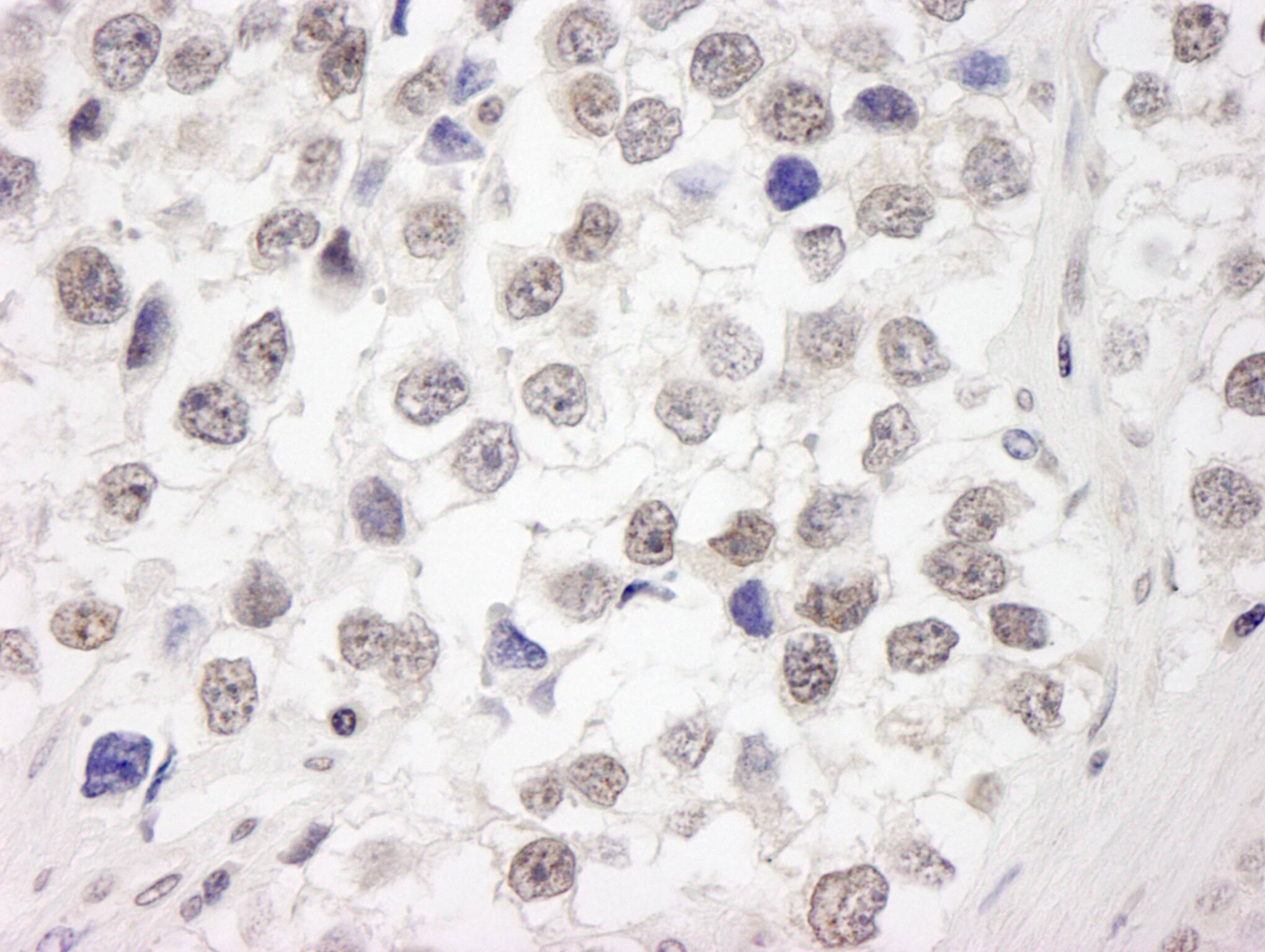 Immunohistochemistry:[NBP3-29339]-Detection of human RAP80 by immunohistochemistry. Sample: FFPE section of human seminoma. Antibody: Affinity purified rabbit anti-RAP80.