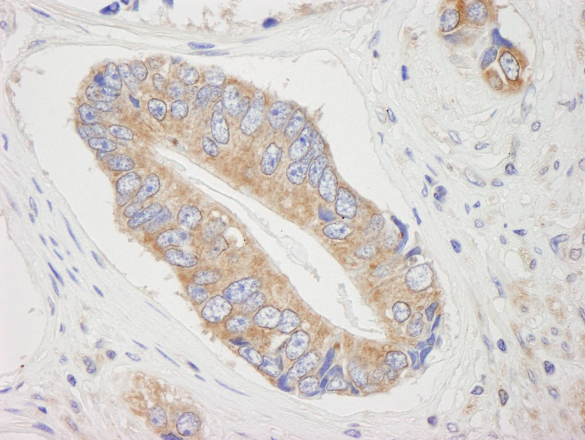 Immunohistochemistry:[NBP3-29342]-Detection of human 4E-T/elF4E-T by immunohistochemistry. Sample: FFPE section of human prostate. Antibody: Affinity purified rabbit anti-4E-T/elF4E-T.