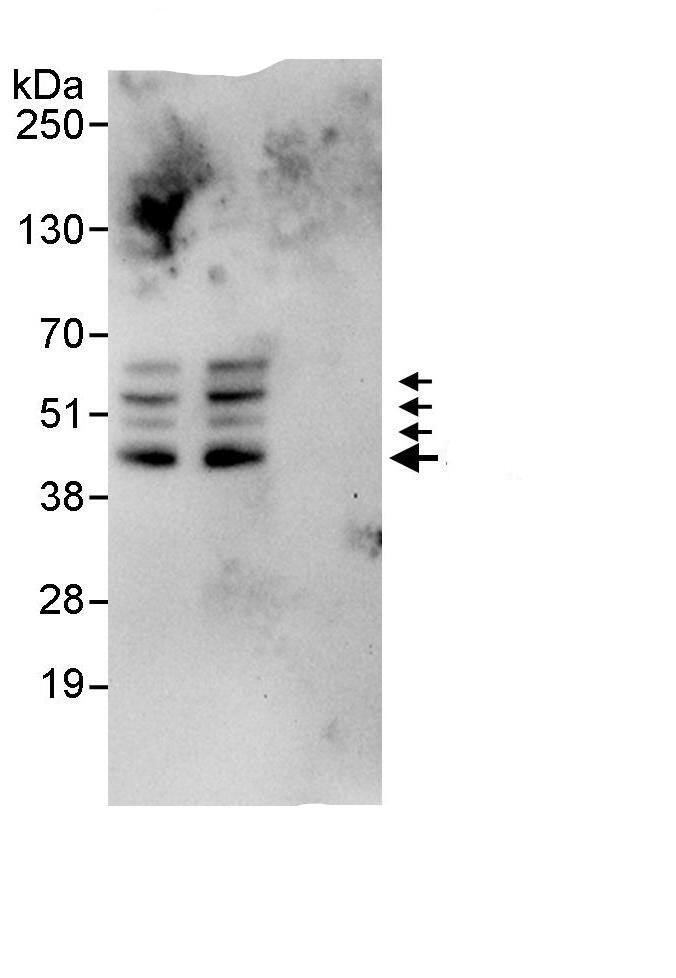 Immunoprecipitation:Sphingosine Kinase 1/SPHK1 AntibodyNBP3-29344] -Detection of human SPHK1 by western blot of immunoprecipitates. Samples: Whole cell lysate (1 mg for IP, 20% of IP loaded) from HeLa cells. Antibodies: Affinity purified rabbit anti-SPHK1 antibody NBP3-29344 used for IP at 10 µg/mg lysate. SPHK1 was also immunoprecipitated by rabbit anti-SPHK1., which recognizes a downstream epitope. For blotting immunoprecipitated SPHK1,  was used at 1 µg/ml. Detection: Chemiluminescence with an exposure time of 30 seconds. Note: The more slowly migrating bands are believed to represent additional forms of SPHK1 owing to recognition by multiple antibodies each of which was directed toward distinctly different epitopes on SPHK1.