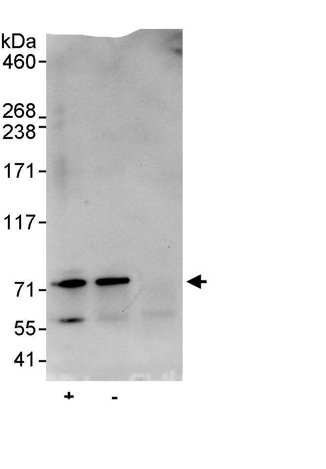 Immunoprecipitation:MED26 AntibodyNBP3-29345] -Detection of human CRSP7 by western blot of immunoprecipitates. Samples: Whole cell lysate (1 mg for IP, 20% of IP loaded) from HeLa cells. Antibodies: Affinity purified rabbit anti-CRSP7 antibody NBP3-29345 used for IP at 10 µg/mg lysate. CRSP7 was also immunoprecipitated by rabbit anti-CRSP7., which recognizes a downstream epitope. For blotting immunoprecipitated CRSP7, NBP3-29345 was used at 0.4 µg/ml. Detection: Chemiluminescence with an exposure time of 15 seconds.