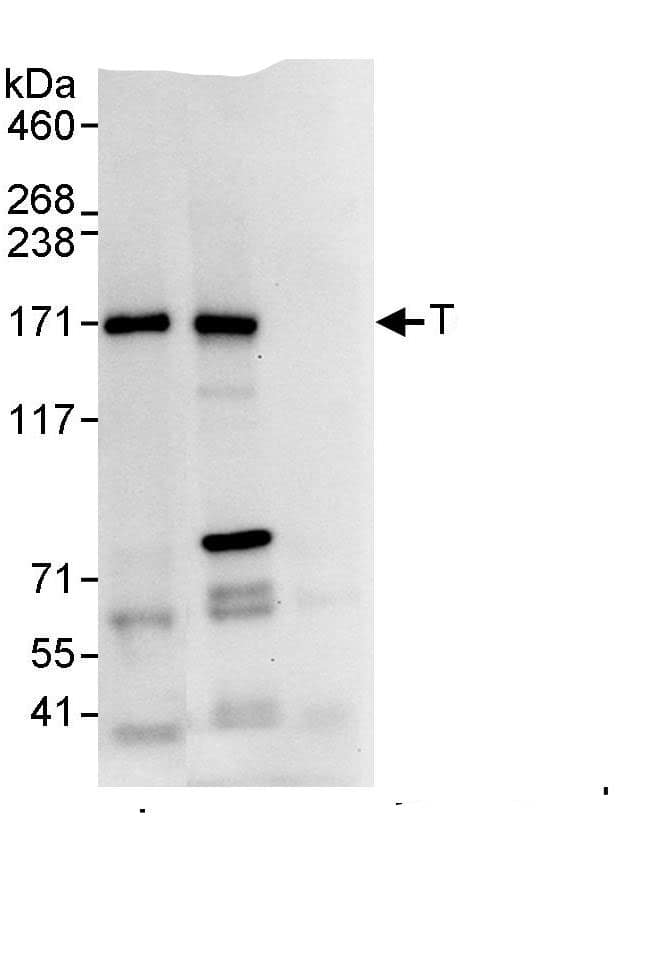 Immunoprecipitation:Tankyrase 1 AntibodyNBP3-29346] -Detection of human Tankyrase 1 by western blot of immunoprecipitates. Samples: Whole cell lysate (1 mg for IP, 20% of IP loaded) from HeLa cells. Antibodies: Affinity purified rabbit anti-Tankyrase 1 antibody NBP3-29346 used for IP at 10 µg/mg lysate. Tankyrase 1 was also immunoprecipitated by rabbit anti-Tankyrase 1., which recognizes a downstream epitope. For blotting immunoprecipitated Tankyrase 1, A302-399A was used at 1 µg/ml. Detection: Chemiluminescence with an exposure time of 10 seconds.