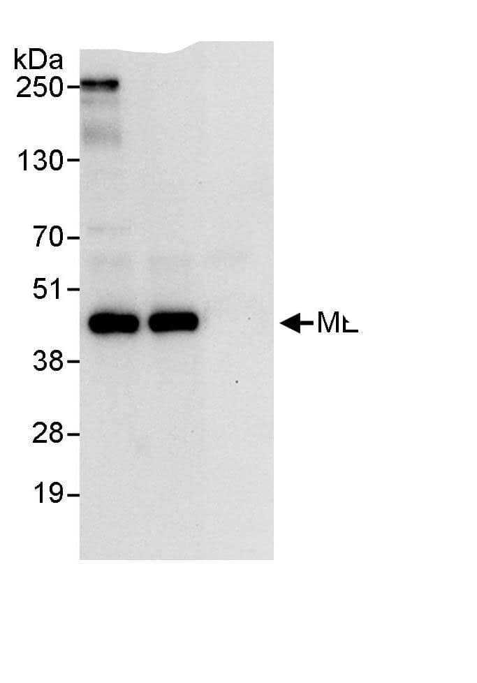 Immunoprecipitation:MERIT40/HSPC142 AntibodyNBP3-29347] -Detection of human MERIT40 by western blot of immunoprecipitates. Samples: Whole cell lysate (1 mg for IP, 20% of IP loaded) from HeLa cells. Antibodies: Affinity purified rabbit anti-MERIT40 antibody NBP3-29347 used for IP at 3 µg/mg lysate. MERIT40 was also immunoprecipitated by rabbit anti-MERIT40., which recognizes a downstream epitope. For blotting immunoprecipitated MERIT40, NBP3-29347 was used at 1 µg/ml. Detection: Chemiluminescence with an exposure time 10 seconds.