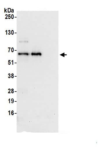 Immunoprecipitation:MON1B AntibodyNBP3-29349] -Detection of human MON1B by western blot of immunoprecipitates. Samples: Whole cell lysate (1.0 mg per IP reaction; 20% of IP loaded) from 293T cells prepared using NETN lysis buffer. Antibodies: Affinity purified rabbit anti-MON1B antibody (NBP3-29349 lot 1) used for IP at 6 µg per reaction. MON1B was also immunoprecipitated by rabbit anti-MON1B.. For blotting immunoprecipitated MON1B, NBP3-29349 was used at 0.4 mg/ml. Detection: Chemiluminescence with an exposure time of 10 seconds.