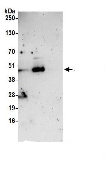 Immunoprecipitation:SLC25A46 AntibodyNBP3-29350] -Detection of human SLC25A46 by western blot of immunoprecipitates. Samples: Whole cell lysate (1.0 mg per IP reaction; 20% of IP loaded) from Jurkat cells prepared using NETN lysis buffer. Antibodies: Affinity purified rabbit anti-SLC25A46 antibody (NBP3-29350 lot 1) used for IP at 6 µg per reaction. SLC25A46 was also immunoprecipitated by rabbit anti-SLC25A46 antibody. For blotting immunoprecipitated SLC25A46, NBP3-29350 was used at 0.4 mg/ml. Detection: Chemiluminescence with an exposure time of 3 minutes.