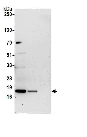 Immunoprecipitation:TMEM85 AntibodyNBP3-29352] -Detection of human EMC4 by western blot of immunoprecipitates. Samples: Whole cell lysate (1.0 mg per IP reaction; 20% of IP loaded) from 293T cells prepared using NETN lysis buffer. Antibodies: Affinity purified rabbit anti-EMC4 antibody (NBP3-29352 lot 1) used for IP at 6 µg per reaction. EMC4 was also immunoprecipitated by rabbit anti-EMC4 antibody BL23129. For blotting immunoprecipitated EMC4, NBP3-29352 was used at 0.4 mg/ml. Detection: Chemiluminescence with an exposure time of 75 seconds.