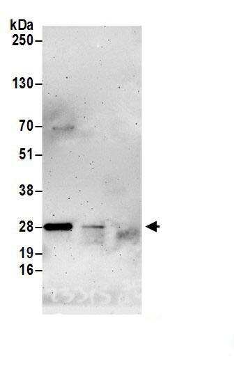 Immunoprecipitation:Latexin AntibodyNBP3-29353] -Detection of human LXN by western blot of immunoprecipitates. Samples: Whole cell lysate (1.0 mg per IP reaction; 20% of IP loaded) from 293T cells prepared using NETN lysis buffer. Antibodies: Affinity purified rabbit anti-LXN antibody (NBP3-29353 lot 1) used for IP at 6 µg per reaction. LXN was also immunoprecipitated by rabbit anti-LXN antibody BL23316. For blotting immunoprecipitated LXN, NBP3-29353 was used at 0.4 mg/ml. Detection: Chemiluminescence with an exposure time of 3 minutes.