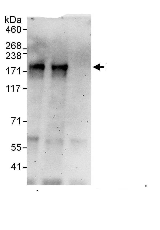 Immunoprecipitation:ZNF687 AntibodyNBP3-29358] -Detection of human ZNF687 by western blot of immunoprecipitates. Samples: Whole cell lysate from HeLa (1 mg for IP, 20% of IP loaded) cells. Antibodies: Affinity purified rabbit anti-ZNF687 antibody NBP3-29358 used for IP at 6 µg/mg lysate. ZNF687 was also immunoprecipitated by rabbit anti-ZNF687., which recognizes an upstream epitope. For blotting immunoprecipitated ZNF687, was used at 0.4 µg/ml. Detection: Chemiluminescence with an exposure time of 3 minutes.