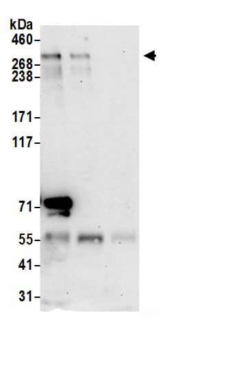 Immunoprecipitation:Myosin VB AntibodyNBP3-29360] -Detection of human MYO5B by western blot of immunoprecipitates. Samples: Whole cell lysate (0.5 or 1.0 mg per IP reaction; 20% of IP loaded) from HeLa cells prepared using NETN lysis buffer. Antibodies: Affinity purified rabbit anti-MYO5B antibody NBP3-29360 (lot NBP3-29360-1) used for IP at 6 µg per reaction. MYO5B was also immunoprecipitated by rabbit anti-MYO5B antibody. For blotting immunoprecipitated MYO5B, NBP3-29360 was used at 1 µg/ml. Detection: Chemiluminescence with an exposure time of 30 seconds.