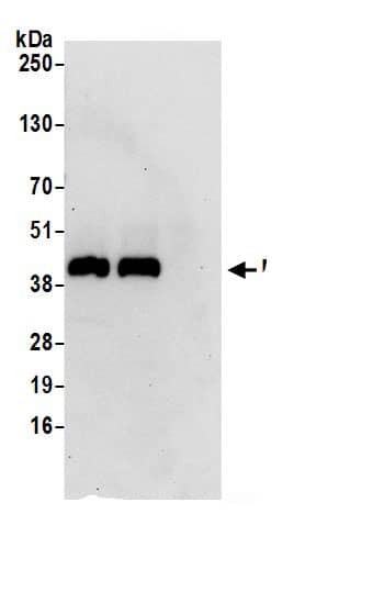 Immunoprecipitation:Mannose Phosphate Isomerase AntibodyNBP3-29361] -Detection of human MPI by western blot of immunoprecipitates. Samples: Whole cell lysate (0.5 or 1.0 mg per IP reaction; 20% of IP loaded) from 293T cells prepared using NETN lysis buffer. Antibodies: Affinity purified rabbit anti-MPI antibody NBP3-29361 (lot NBP3-29361-1) used for IP at 6 µg per reaction. MPI was also immunoprecipitated by rabbit anti-MPI.. For blotting immunoprecipitated MPI, NBP3-29361 was used at 1 µg/ml. Detection: Chemiluminescence with an exposure time of 30 seconds.